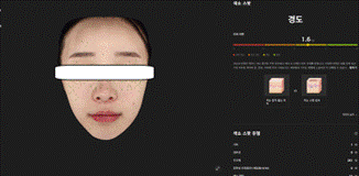 대전색소침착, 개선하려면? 레이저 토닝 종류부터 부작용까지 정리