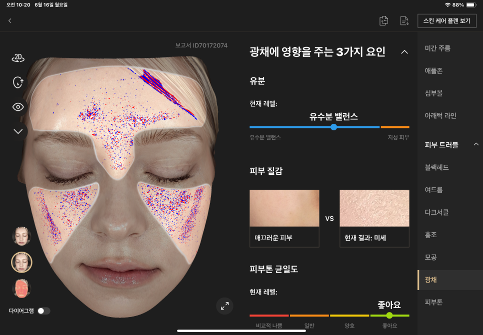 대전스킨보톡스 주름 보톡스와의 차이는?