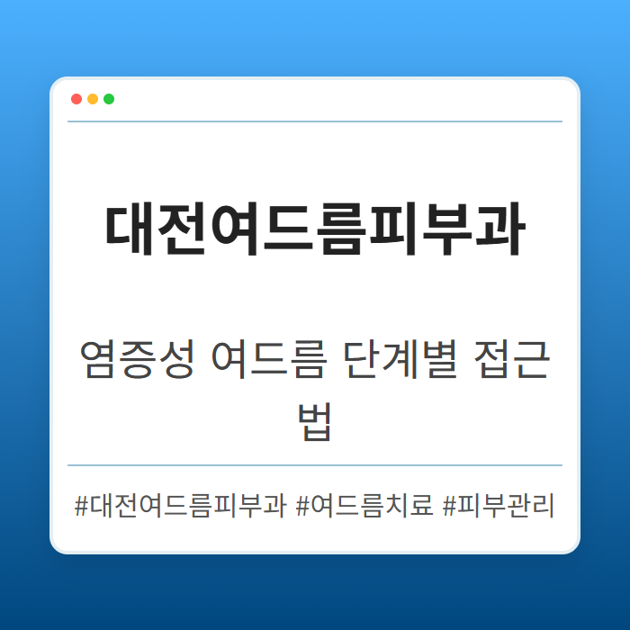 염증성 여드름 단계별 대전여드름피부과 접근법