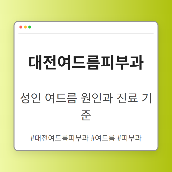 성인 여드름 원인 분석 대전여드름피부과 진료 기준